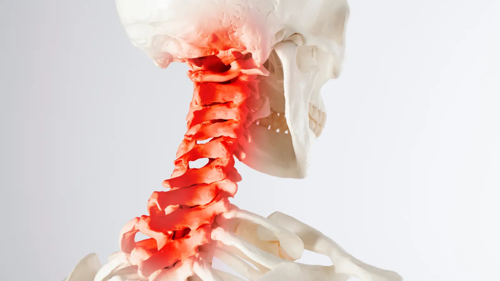 Skręcenie kręgosłupa szyjnego po stłuczce – co dalej Prawdziwa historia, która zakończyła się ugodą na 14 000 zł